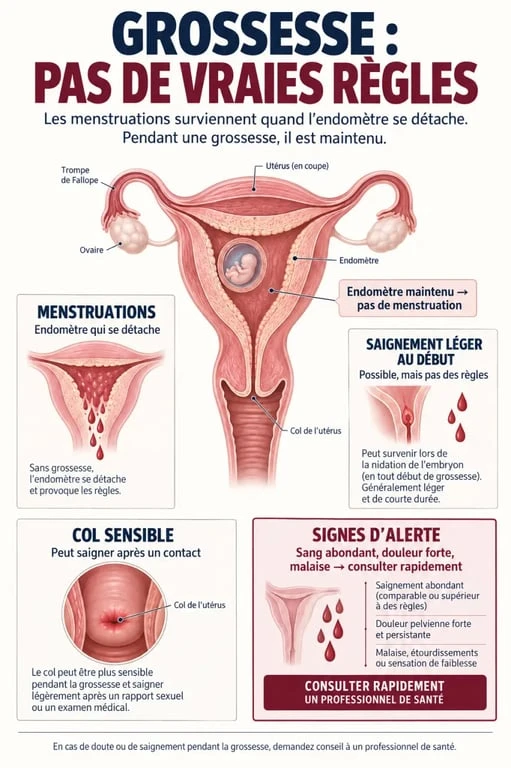 Témoignage de femme enceinte ayant eu leur règles : schéma des différents types de saignements pendant la grossesse
